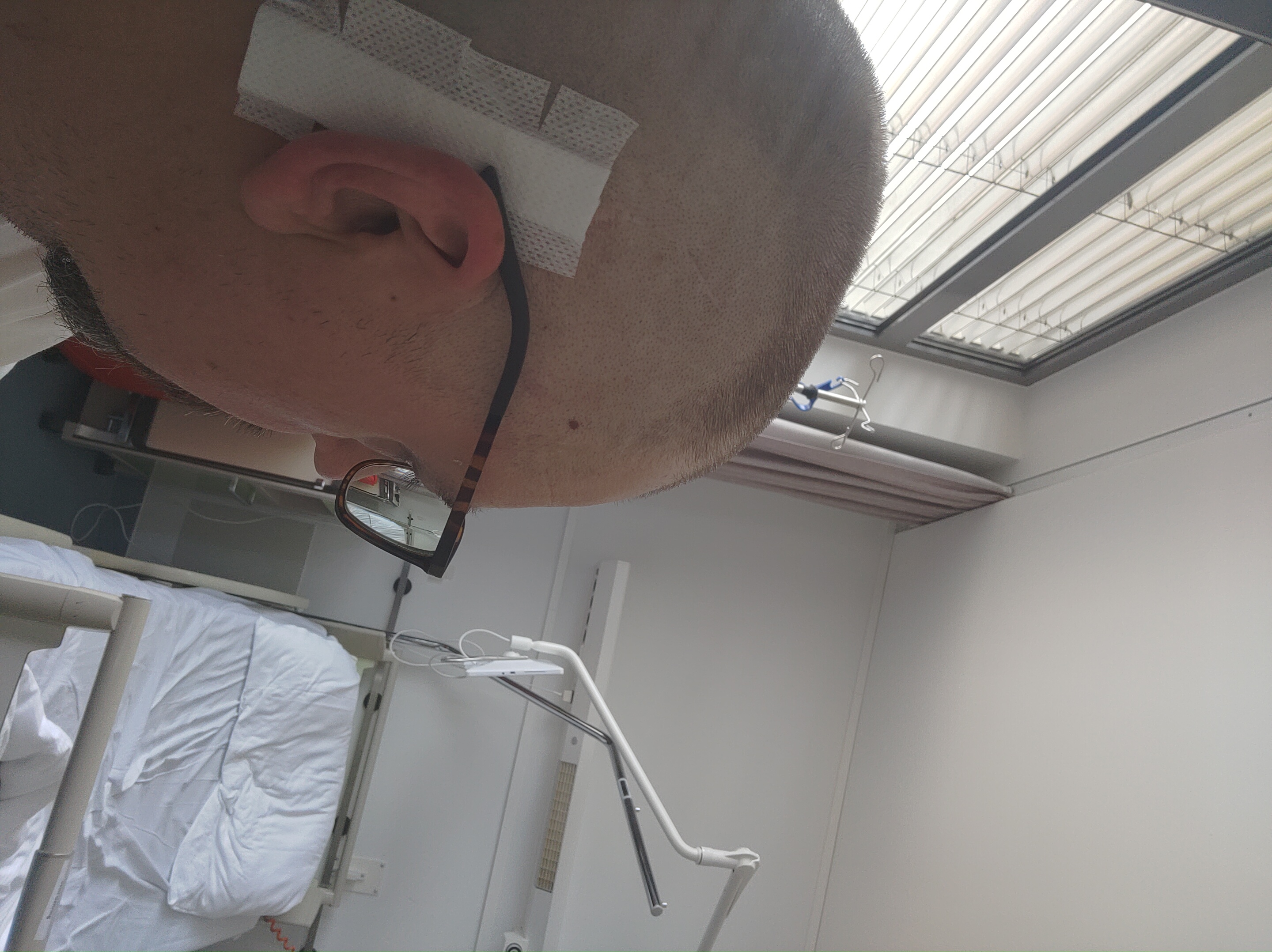 2023.06.08 2 Tage nach CI-OP